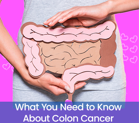 What-You-Need-to-Know-About-Colon-Cancer---Women